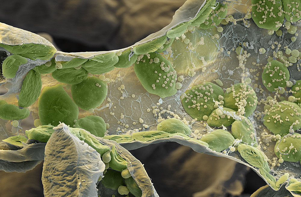 Chloroplasts / Chloroplasten